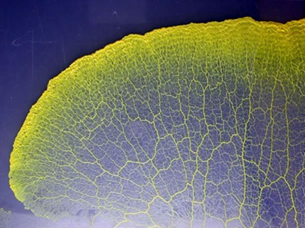 　図2　真正粘菌変形体 ※
　※上記の図1、図2の画像、キャプションをクリックすると画像の出典元の科学技術振興機構の
　　Webサイトへリンクします。